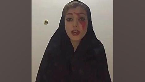 دابسمش امیر تتلو