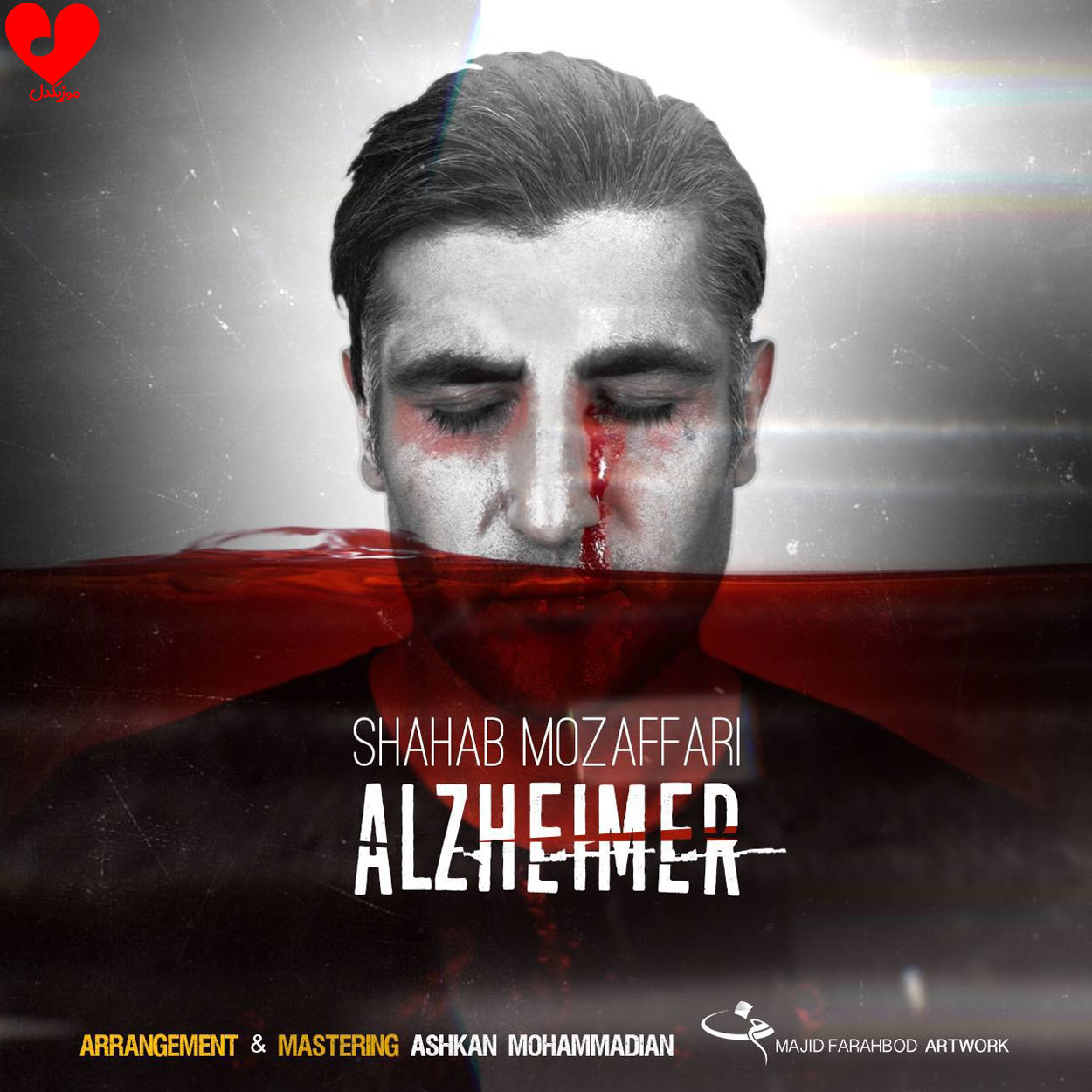 آلزایمر