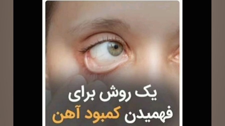 کم خونی