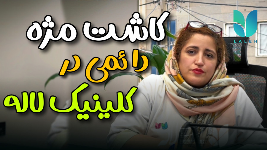 مژه